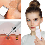 Ultrasonic Scrubber